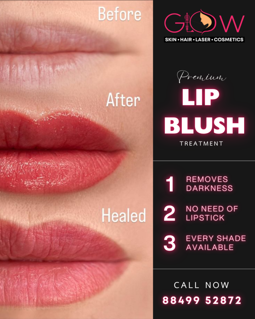 Lip Lightening Treatment Vadodara at Glow Skin Clinic